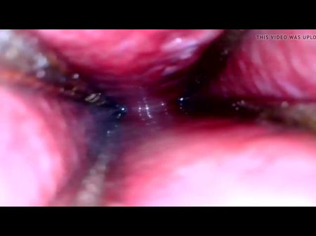 depilation pene